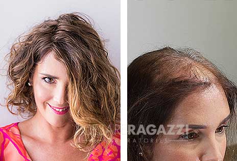 CRLAB women's hair replacement dayton ohio